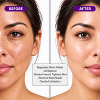 Niacinamide Serum – For Refined Pores, Oil Balance and Smooth, Bright Skin
