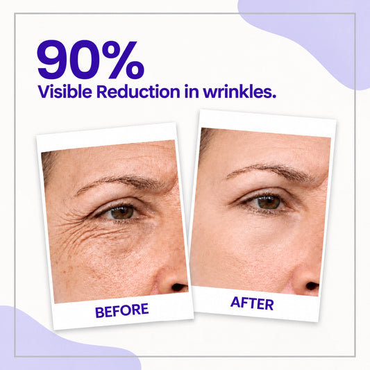 Retinol Night Cream – For Anti-Aging, Wrinkles and Smooth-Looking Skin