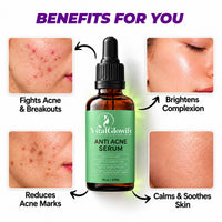Anti-Acne Serum – For Acne, Pimples, Dark Spots & Oil Control