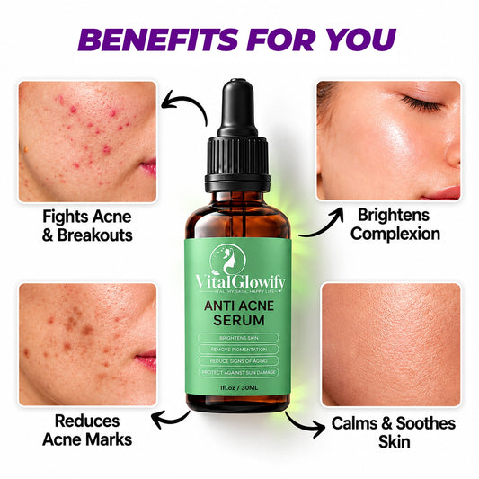 Anti-Acne Serum – For Acne, Pimples, Dark Spots & Oil Control