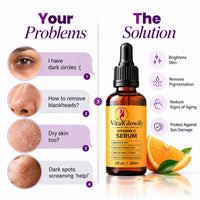 Vitamin C Serum – For Brightening, Hydration and Anti-Aging Care