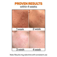 Vitamin C Serum – For Brightening, Hydration and Anti-Aging Care