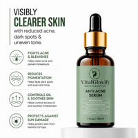 Anti-Acne Serum – For Acne, Pimples, Dark Spots & Oil Control